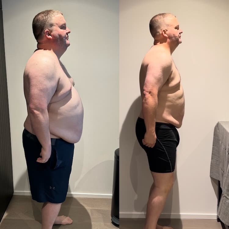 Client transformation - man major weight loss side profile